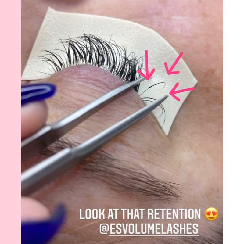 eslashes retention with superbonder 